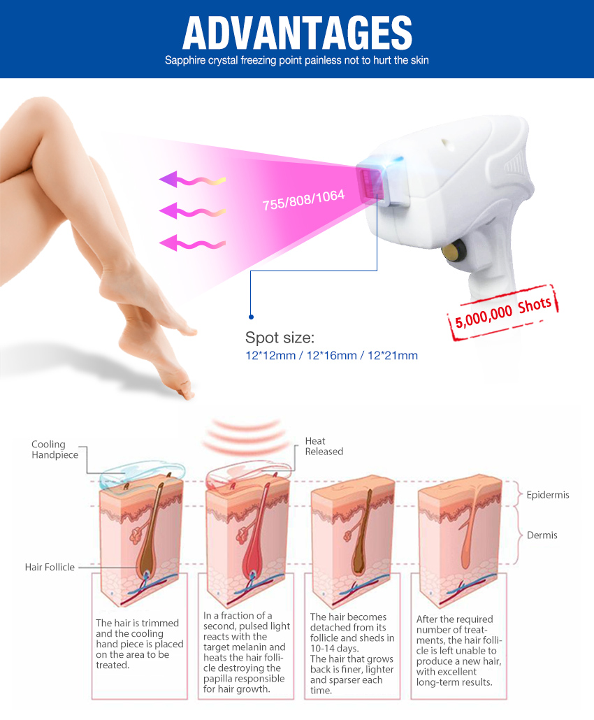 Diode Laser 808nm Hair Removal Machine Buy Laser Diode 808nm Diode