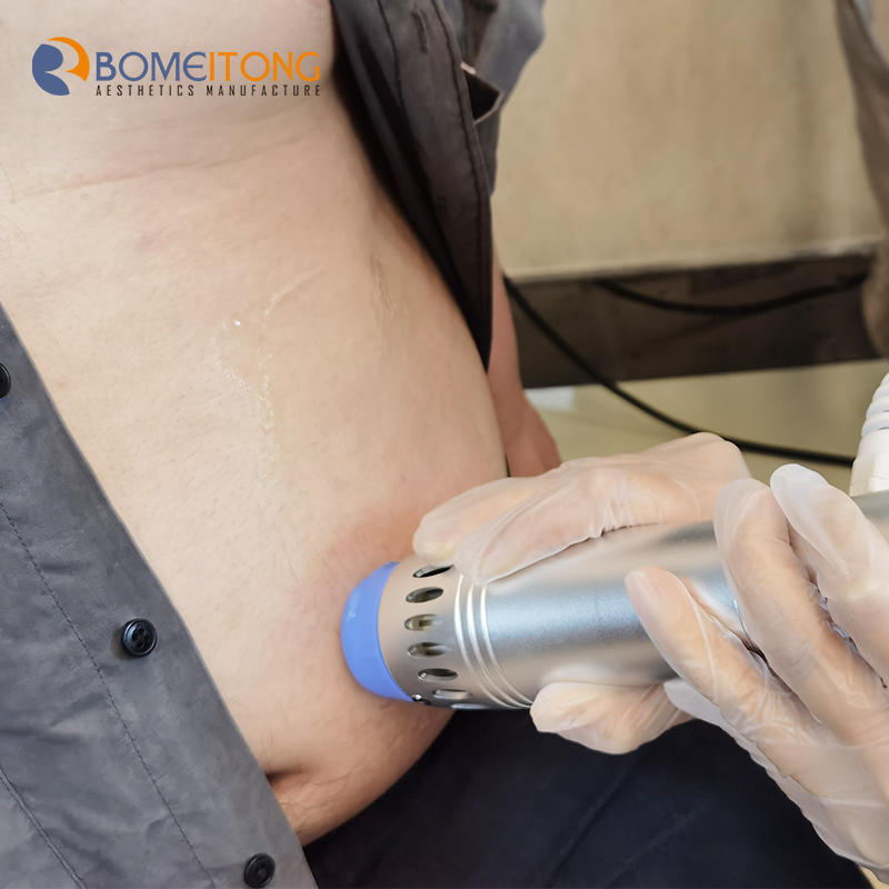 Shokwave shockwave therapy machine acustik cellulite pain relief focused extracorporeal